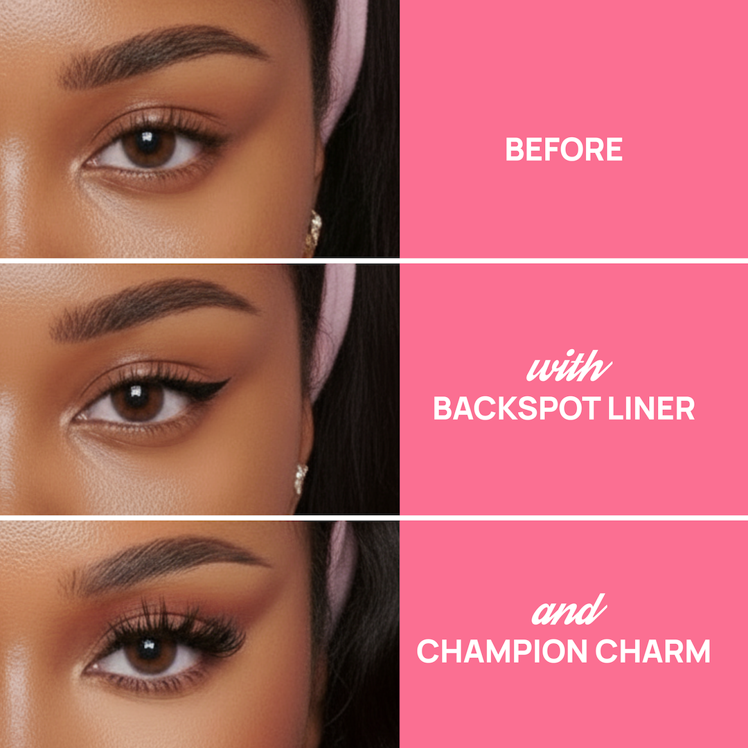 Champion Charm + BackSpot Liner Set